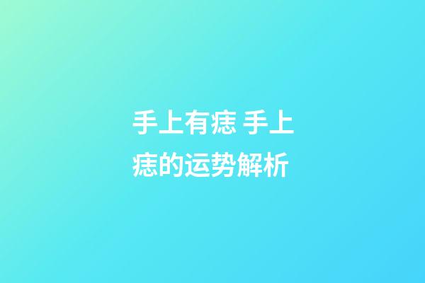 手上有痣 手上痣的运势解析